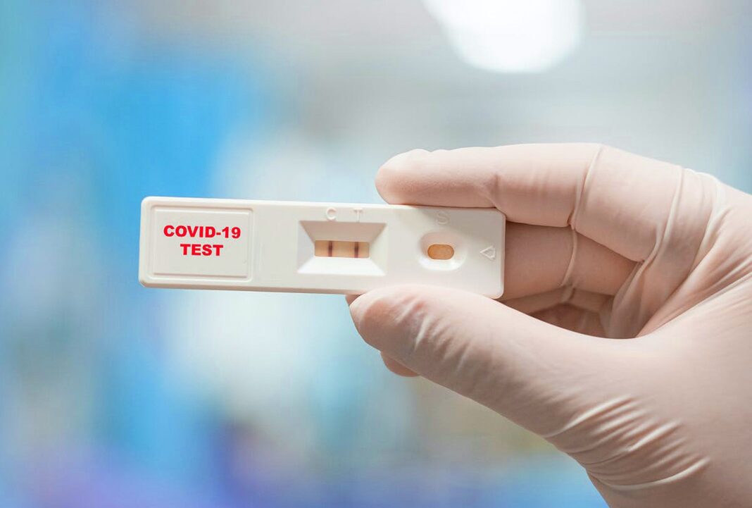 Medicii de familie teste rapide antigen