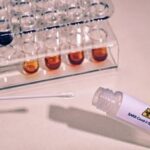 Un nou test PCR identifică tulpina Omicron