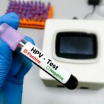 Ghid pas cu pas pentru prevenirea infectiei cu HPV