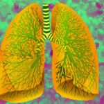 Studiu: Expunerea timpurie la poluarea atmosferică are legătură cu sănătatea pulmonară mai târziu în viaţă