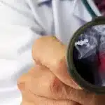 Spondiloza cervicală: ce este, cum afectează coloana vertebrală și care sunt opțiunile de tratament