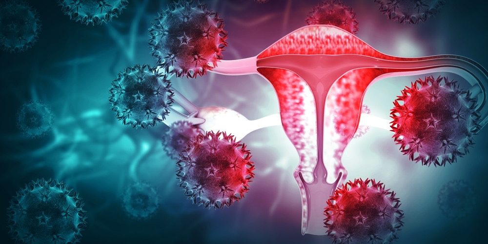 7 tipuri de infecții vaginale și ce trebuie să știi despre e