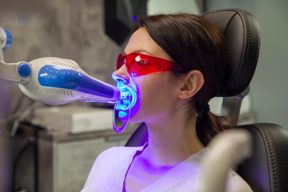 Albire dentară laser: cât este de sigură procedura și cui i 